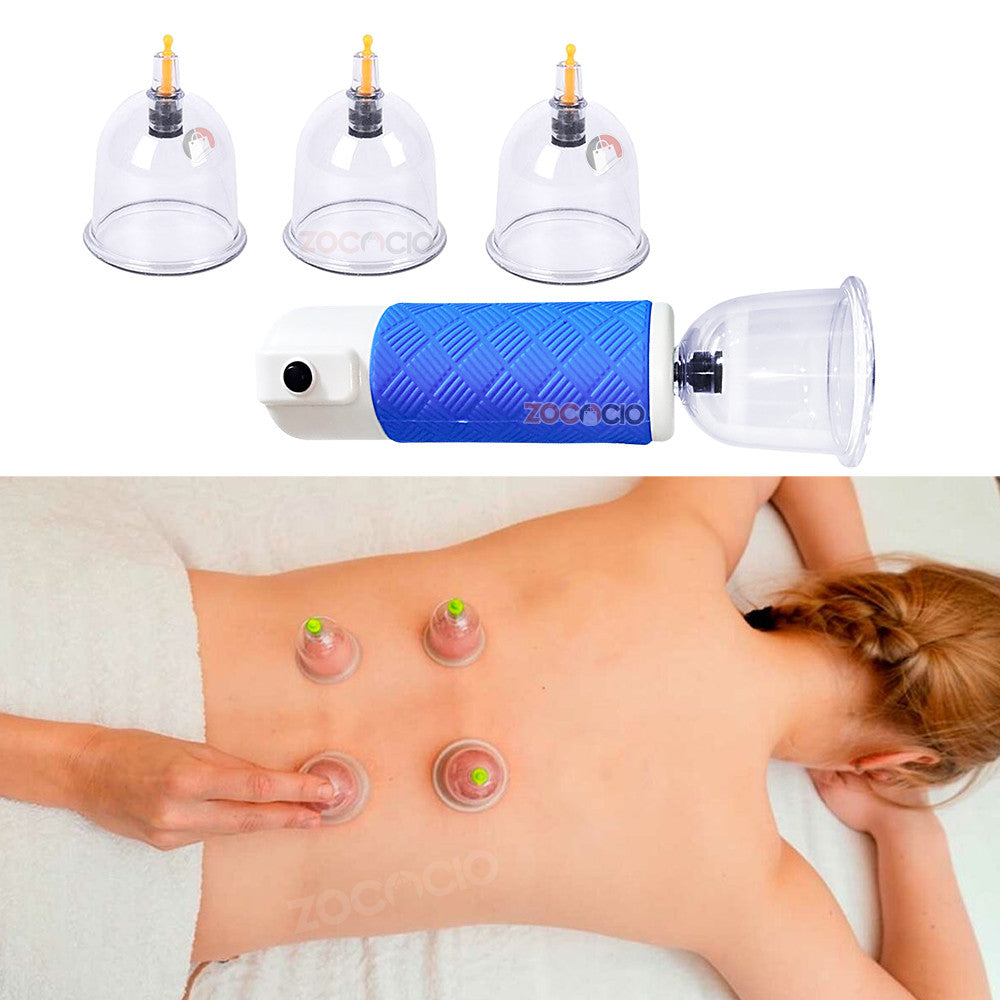 Vacumterapia Eléctrica Masajeador Corporal