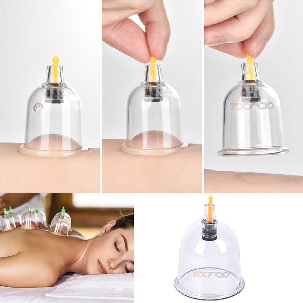 Vacumterapia Eléctrica Masajeador Corporal